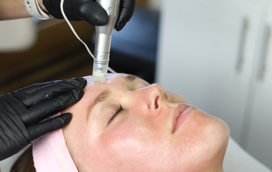 ACS PEN MICRO NEEDLING